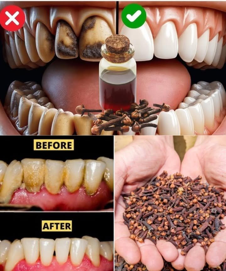A title like "9 Natural Ways to Remove Plaque & Tartar Buildup" needs an important clarification: