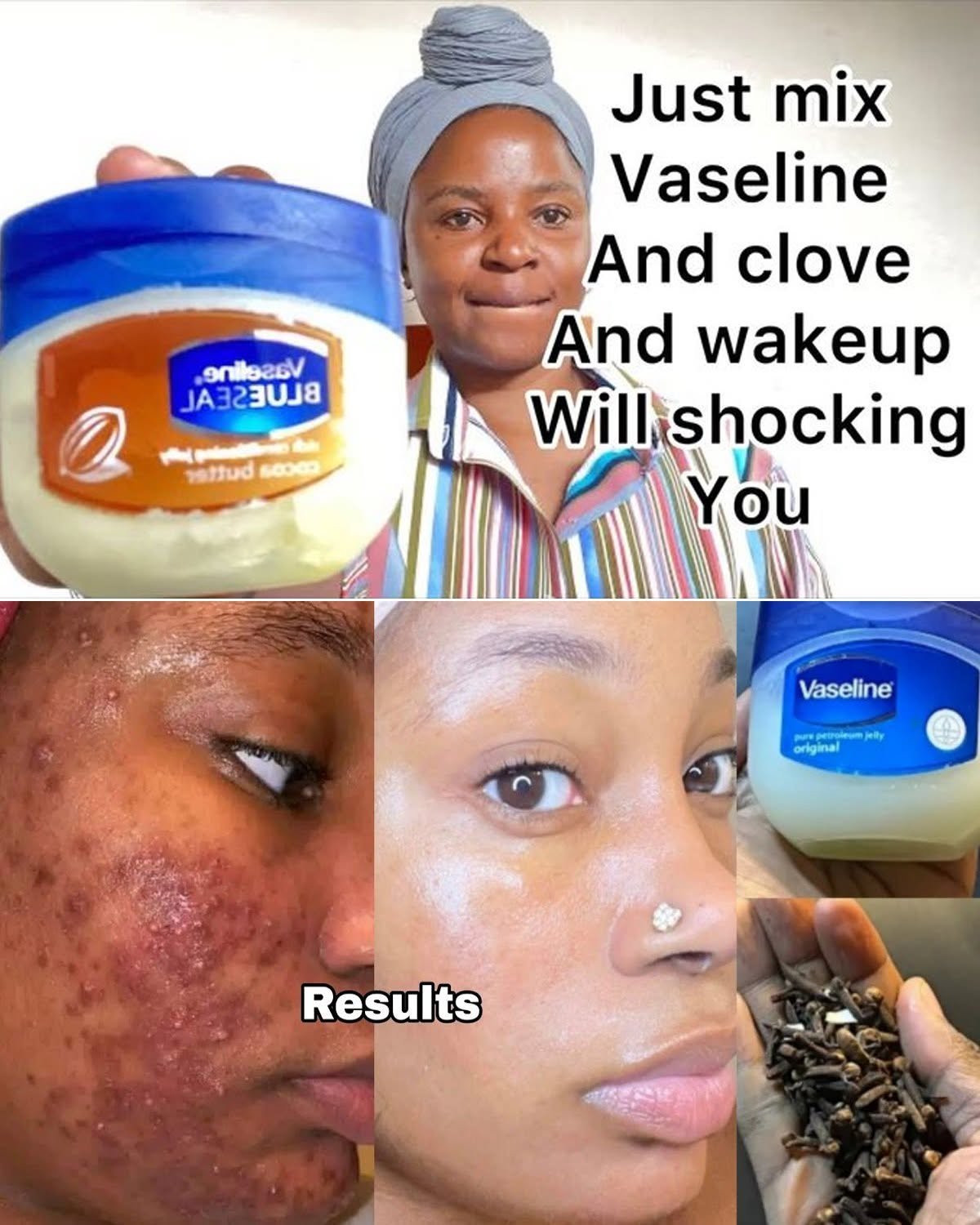 Cloves and Vaseline: A Secret Beauty Hack You’ll Wish You Knew
