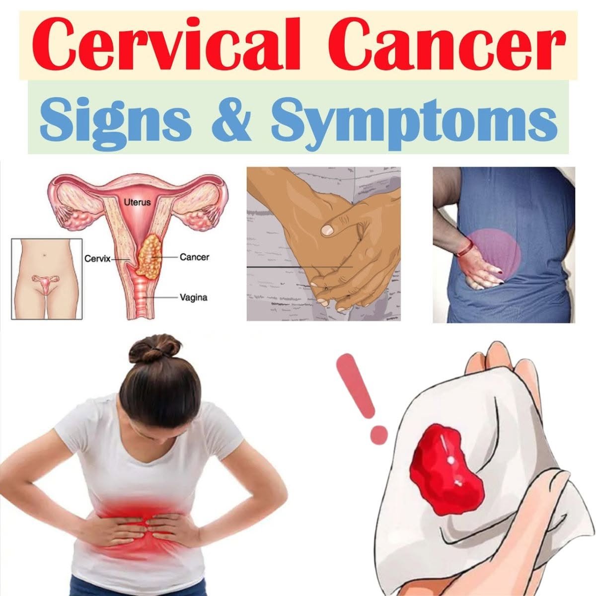 Cervical Cancer: Early Signs and Symptoms You Should Never Ignore