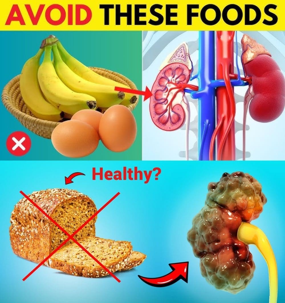 The title "12 Foods That Are DESTROYING Your Unhealthy Kidneys You Should AVOID!"