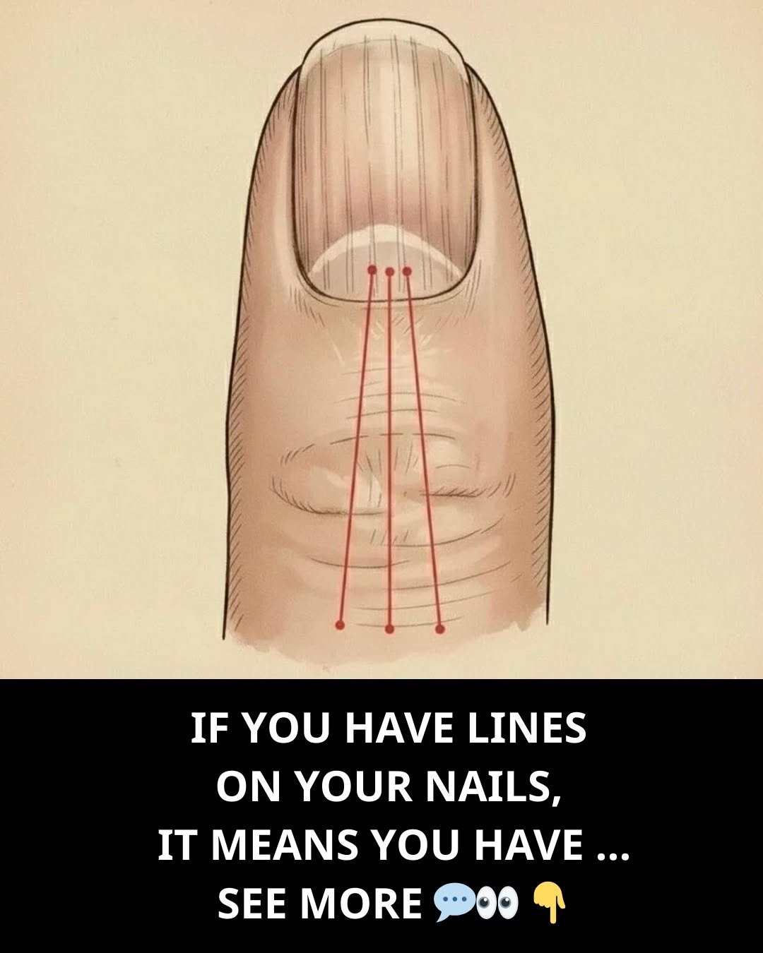 If you have lines on your nails, it means you have ...See more