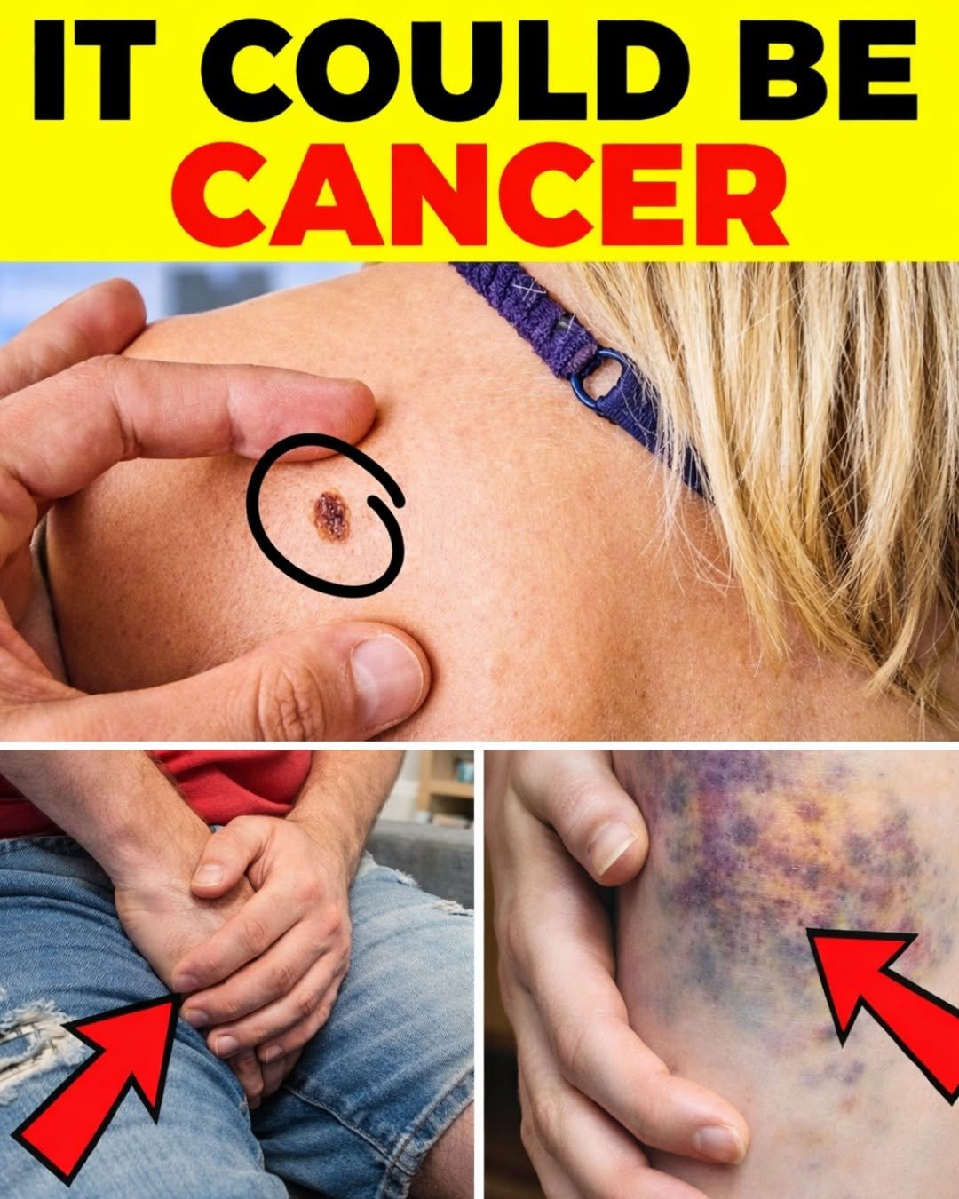 The 14 Warning Signs of Cancer You Should Never Ignore – Early Detection Could Save Your Life
