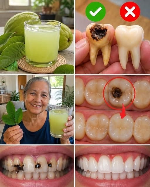 🌿 3 Powerful Ways to Use Guava Leaves for Oral Care (Step-by-Step Simple Version)